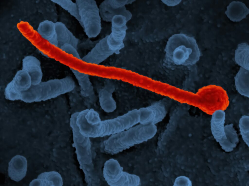 EBOLA Virus Under microscope
